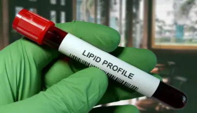 Lipids Thumbnail